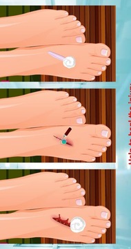 修脚损伤后 - 女孩游戏截图4