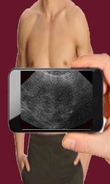 Ultrasound Scanner (Prank)游戏截图2