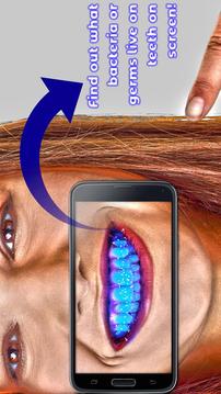 Teeth Germ Scanner Simulator App游戏截图4