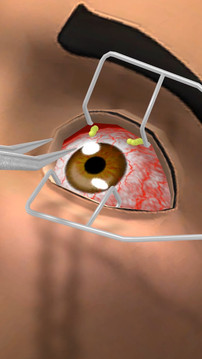 眼科医生游戏截图1