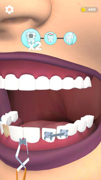 假牙医生游戏截图2