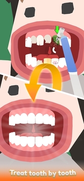 空闲的牙医游戏截图2