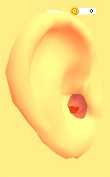 耳垢诊所游戏截图3