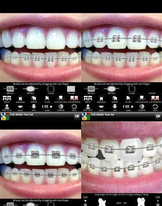 Virtual Dentist截图1