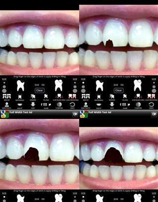 Virtual Dentist截图5