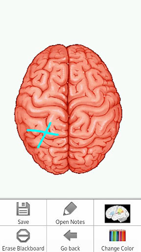 Psychiatry-Neurology Pro截图6