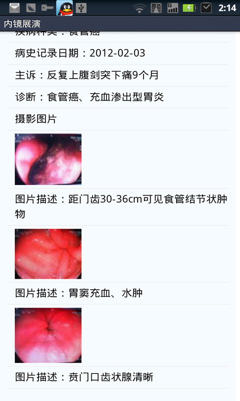 内镜展演截图5