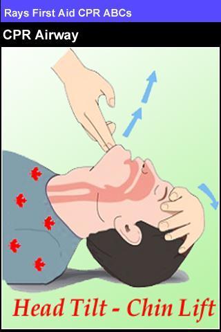 Rays First Aid CPR ABCs截图4