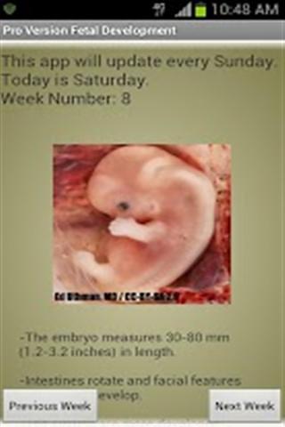 Fetal Development - Week by Week截图4