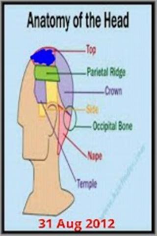 偏头痛图片 Migraine Pic Ad截图2