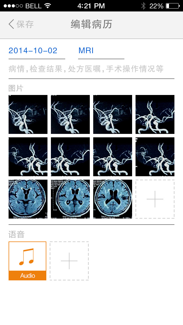 脑专家截图3