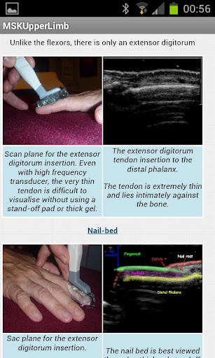 MSK ultrasound upper limb Lite截图4