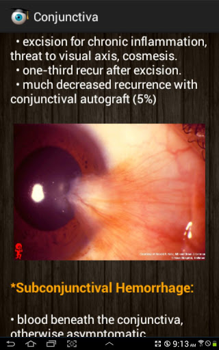 Ophthalmology截图5