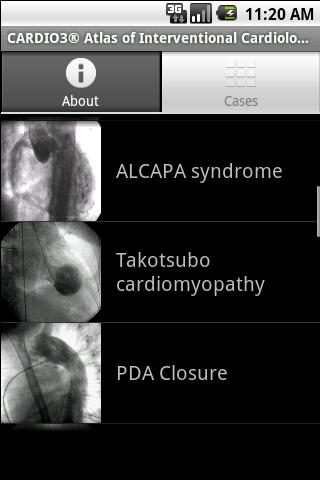 CARDIO3&reg; INVASIVE - Lite截图3