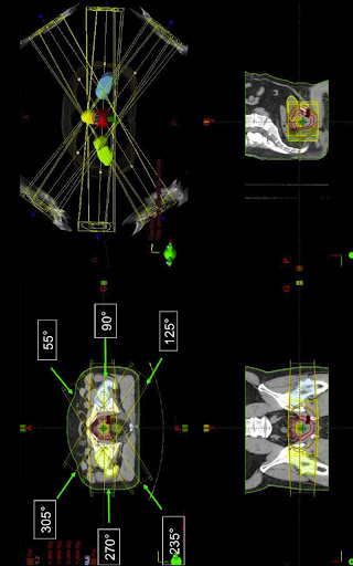 Siriade ORL, Neuro et Sarcome截图3