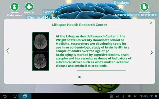 Wright State Brain Scan截图3