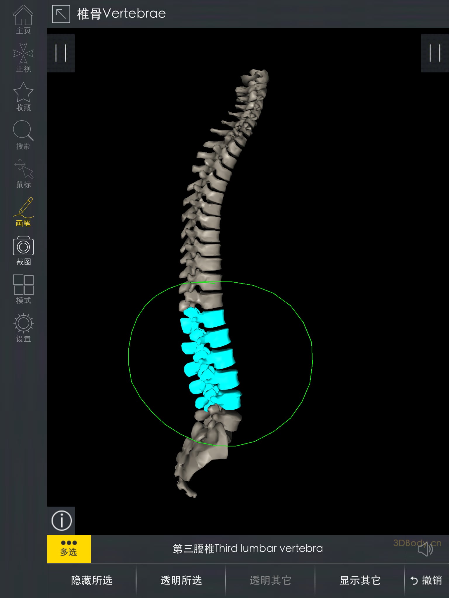 3DBody骨科截图2