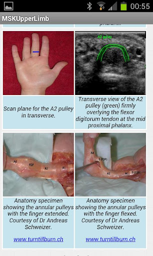 MSK ultrasound upper limb Lite截图2