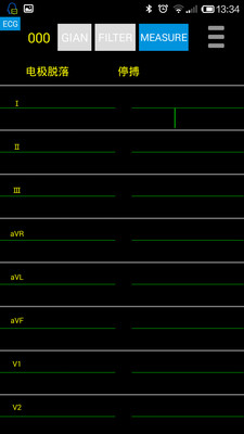 家用心电截图1