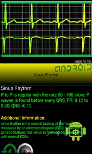 EKG Master截图1