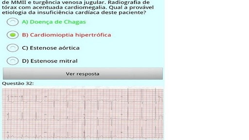 Desafios de ECG Lite截图2