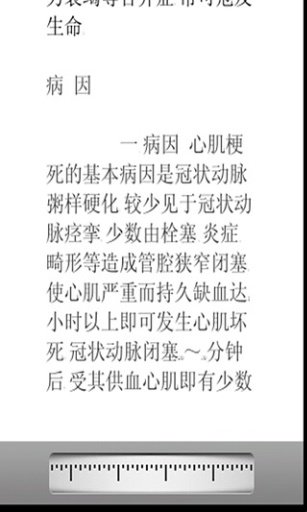 心肌梗死治疗截图4