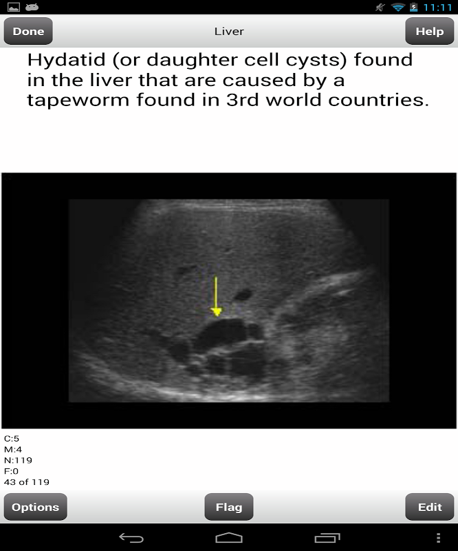 ARRT Sonography (Ultrasound) Flashcards Lite截图2