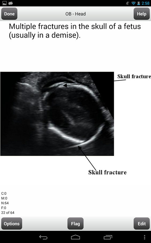 ARRT Sonography (Ultrasound) Flashcards Lite截图9