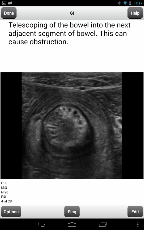 ARRT Sonography (Ultrasound) Flashcards Lite截图1