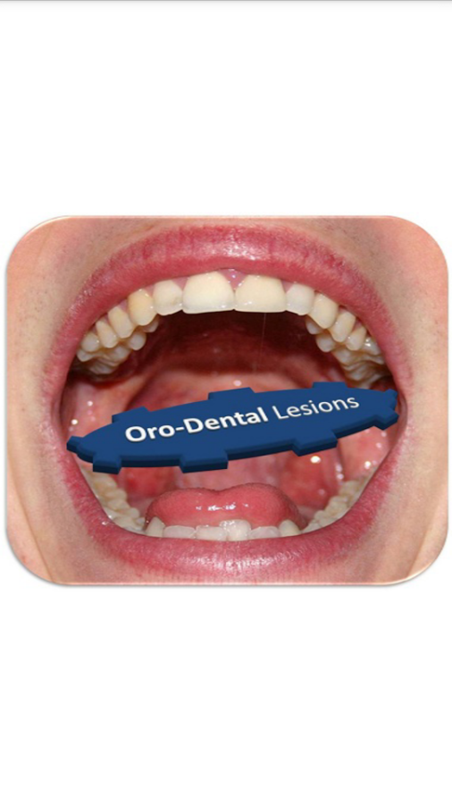 Oro Dental Lesions截图3