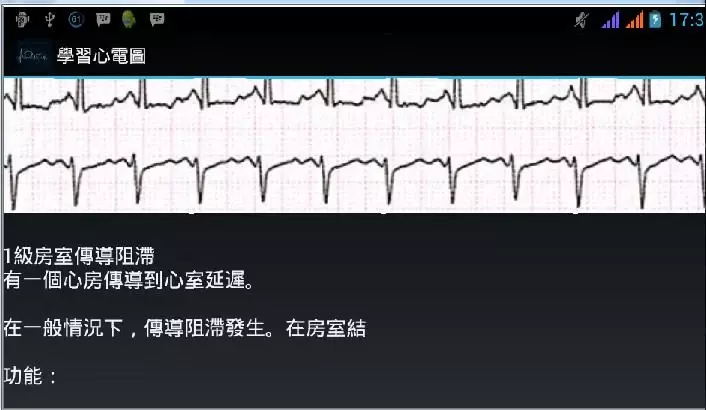 學習心電圖截图3