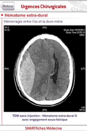 SMARTfiches Urgences Chirurgicales截图4