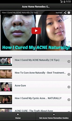 Acne Home Remedies截图1