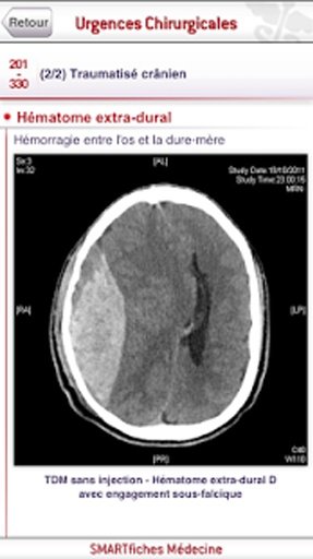 SMARTfiches Urgences Chirurgicales截图7