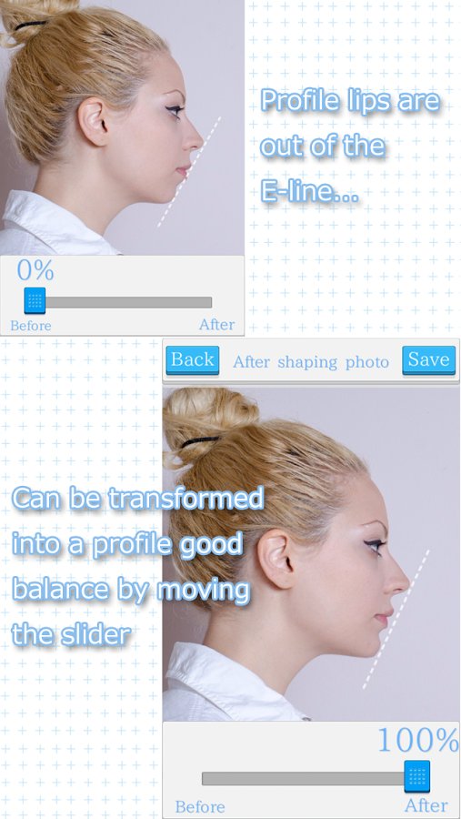 Profile E-Line Shaper截图1