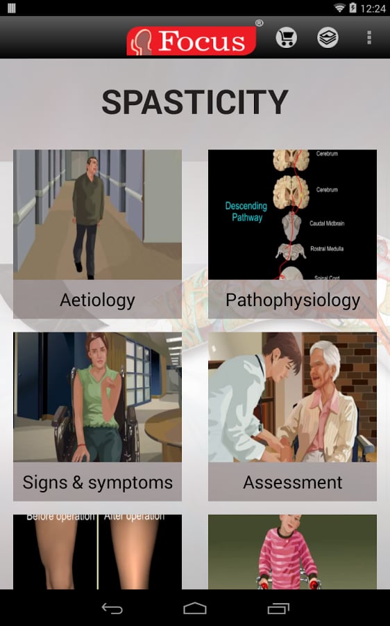 Spasticity- An Overview截图6