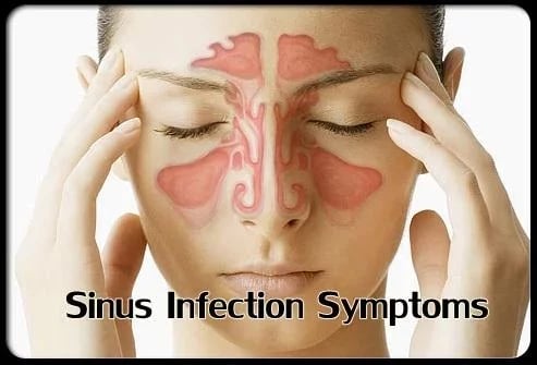 Sinus Infection Symptoms截图1