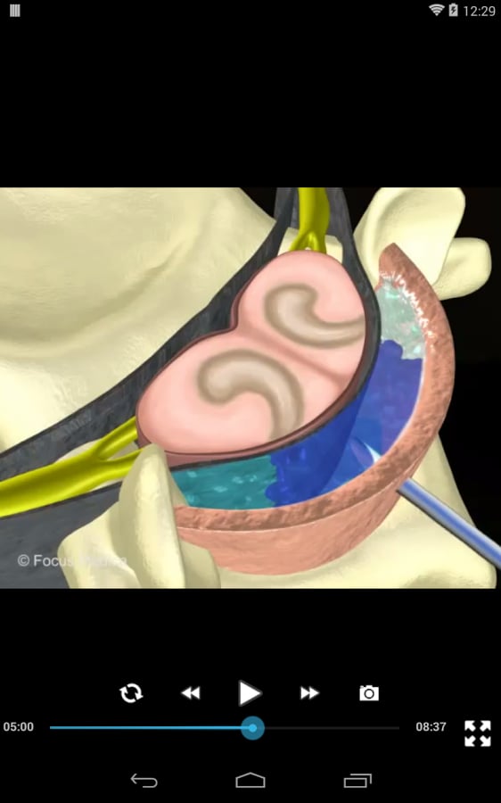 Spasticity- An Overview截图7