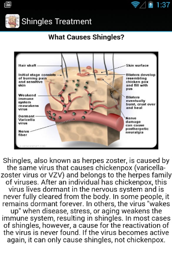 Shingles Symptoms Treatm...截图2