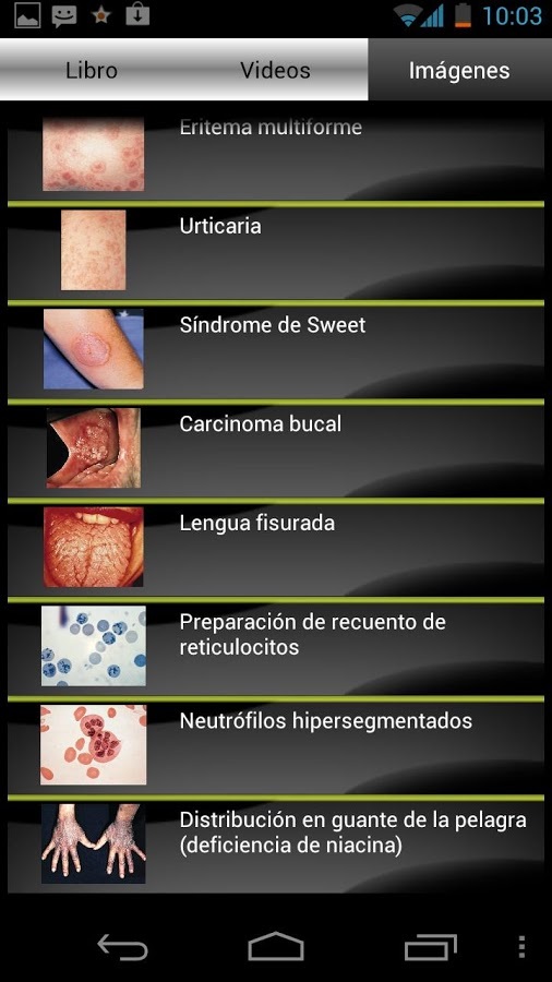 Harrison: Medicina Interna截图4