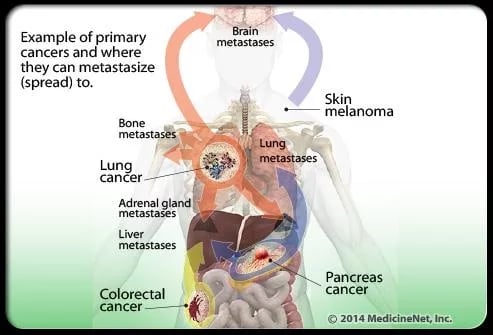 Cancer 101 Treatment截图3