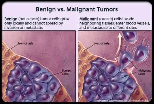 Cancer 101 Treatment截图4