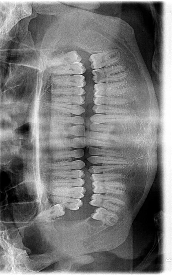 Negatoscope simulator截图1