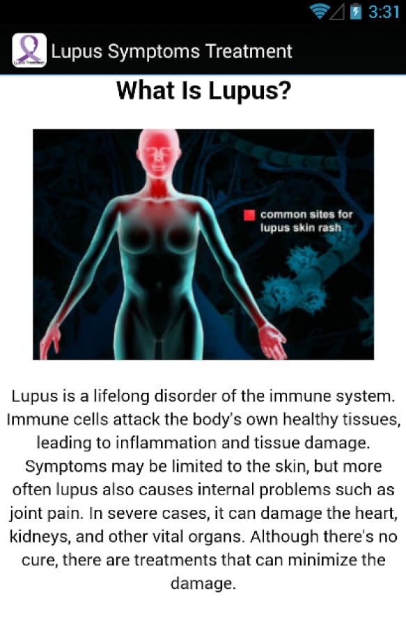 Lupus Symptoms Treatment截图2