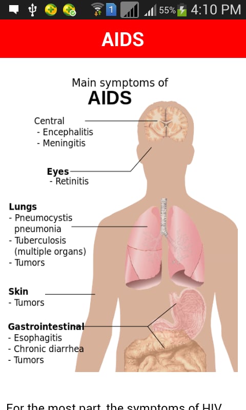 AIDS截图3