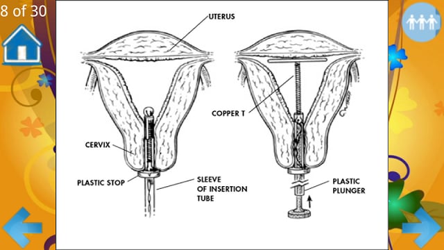 Methods For Birth Control截图3