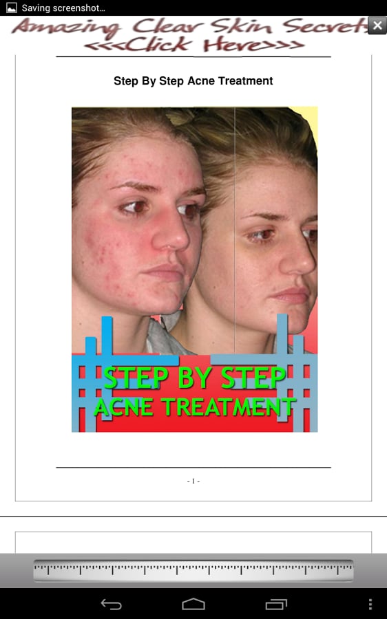 Step By Step Acne Treatm...截图1