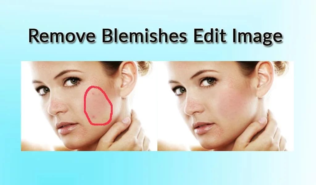 Remove Blemishes Edit Im...截图1