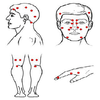 Acupressure Massage截图1