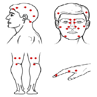 Acupressure Massage截图4